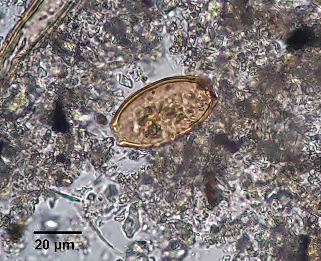 Ovo de Trichuris trichiura encontrado no sedimento retirado da região pélvica do indivíduo UE 27042, exumado da Igreja São Julião, Lisboa